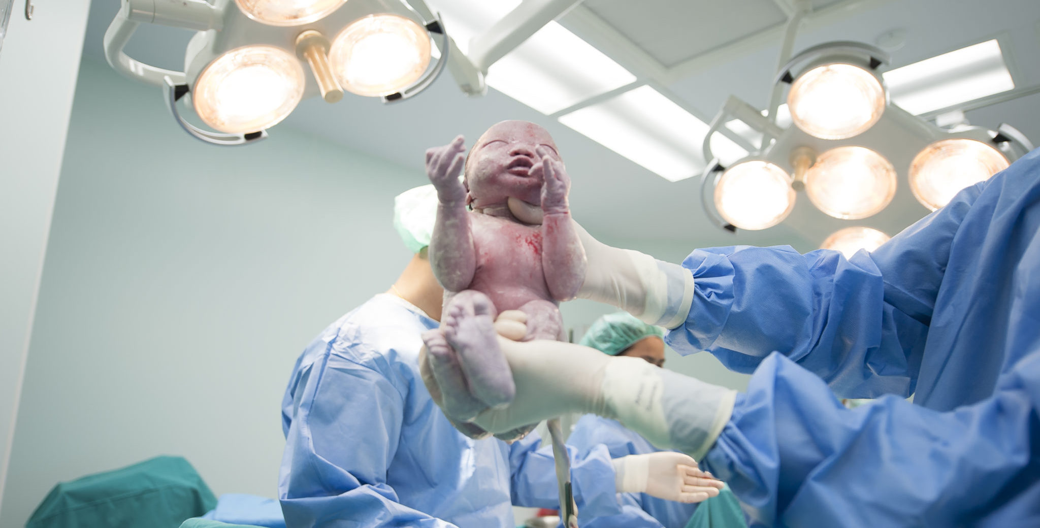 Things you should know about C-Section