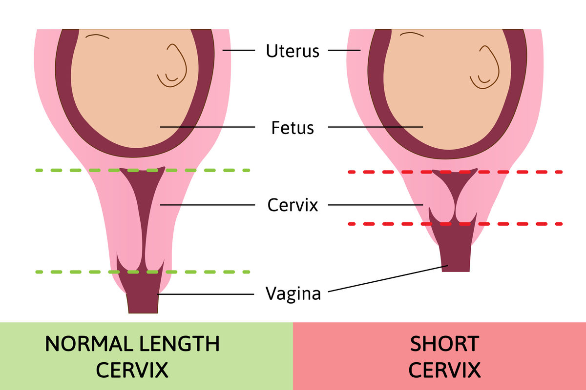 Cervix Before And During Pregnancy